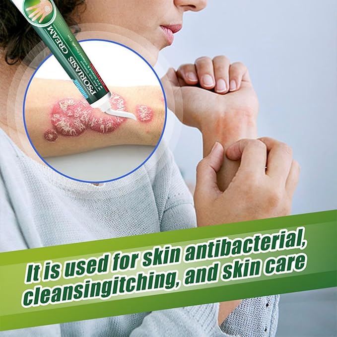 Psoriasis Cream (Original) – 20g